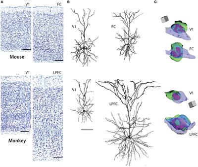 Pyramidal Neurons Are Not Generalizable Building Blocks of Cortical Networks